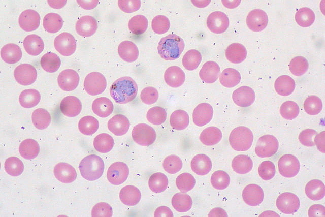 Plasmodium spp. en sangre periférica. Fuente: Ed Uthman/Flickr