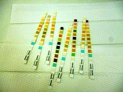 Tiras de pH para test de orina. Fuente: Flickr/ Iqbal Osman