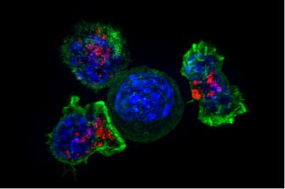 Linfocitos T rodeando una célula cancerosa. Fuente: NICHD/J. Lippincott-Schwartz