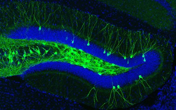 Neuronas en las que se ha insertado el gen de las algas que generan proteínas fotosensibles. Fuente: Dheeraj Roy/Nature